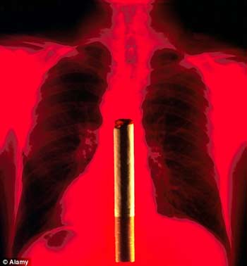 0101.vn - Vì sao không hút thuốc lá vẫn bị ung thư phổi?